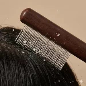 비듬클리너 스케일링참빗 두피 각질 없애는 빗 머릿니 서캐 비듬제거빗