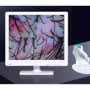 두피진단기 피부측정기 고화질 미용실 모낭 기계 모발