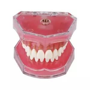 교정 치아모형 덴티폼 치과 교육용 스터디 실습 트레이닝