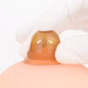 ToB 흡입형 임산부 수유 함몰 유두 인공 보조