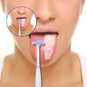 쌍문상회 케어용 관리 위생적인 제거 혀클리너 설태 구강