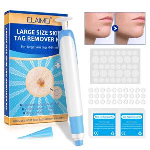 대형 피부 태그 제거 키트 (4-9mm 대형 피부 태그용) 클렌징 스왑 포함 가정용 얼굴 피부 관리 도구
