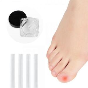 내성 발톱 스틱 찌르는 발톱보호 자가케어 셀프팁 10p