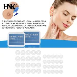 20Pcs 교체 사마귀 고무 반지 Tagband 0.5/1/1.5MM 무통 피부 태그 두더지 제거 밴드 도구