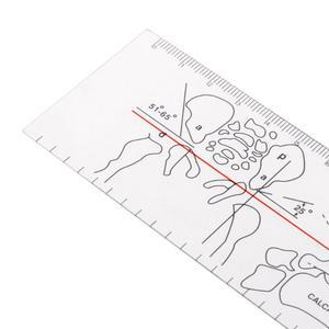 Goniometer 각도 눈금자 규칙 도구 플라스틱 기구