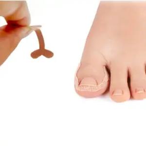 내성발톱 교정기 테이프 12개입 세트 파고드는 발톱 교정 밴드 내향성 발톱 관리