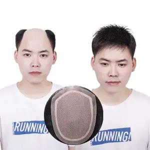 [셀러에이드]인모 남자 두피 붙이는 가발 원형 남성형 가벼운 가발