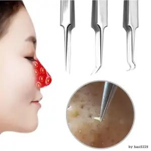 [에스에스_62]피지제거기 짜기 코 얼굴 블랙헤드 압출 바늘