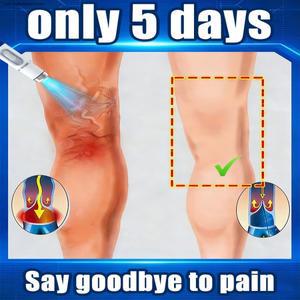 양쪽 다리의 정맥 용 블루라이트 펜, 관리 도구