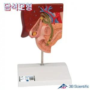 [종로의료기]3B Scientific 인체해부모형 담석모형 K26 Gallstone Model