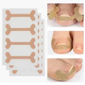 발톱 프로 (12개입세트)테이프 내향성 교정 교정기 밴드