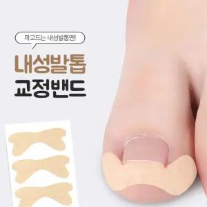 파고드는발톱 내성발톱 발톱보호 교정밴드 30개 자가치료