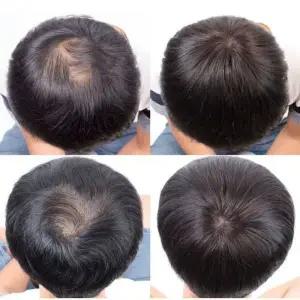 정수리 163 정수리가발 O형 헤어커버가발 인모가발 SE