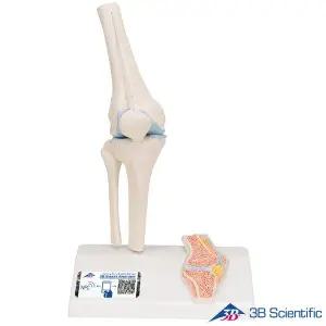 [종로의료기]3B Scientific 무릎관절모형 1/2 미니사이즈 단면포함 A85/1 Knee Joint 관절모형