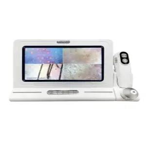 두피진단기 11인치모니터 두피카메라 스캐너 두피현미경