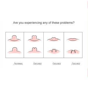 휴대용 여성 젖꼭지 교정기 흡입 펌프 풀러 마사지기 산모 건강 관리 수유 보조