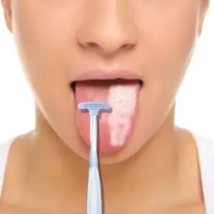 백태제거 텅브러쉬 lVy8+6SEr