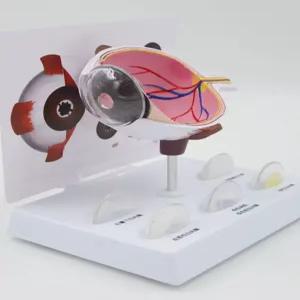 안구모형 안과 눈 교구 병원 인체모형 실습 백내장 인체해부 해부학 망막 분리형 학교