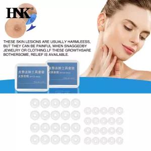 20Pcs 교체 사마귀 고무 반지 Tagband 0.5/1/1.5MM 무통 피부 태그 두더지 제거 밴드 도구