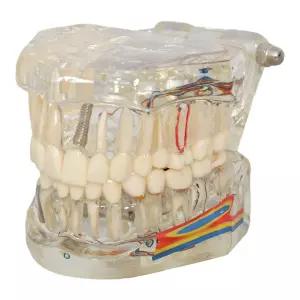 치주 치아모형 구강 이빨모형 덴탈 실습용 부식 관리 양치