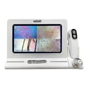 메이보이 브랜드 11인치 두피 진단기 분석기 일체형