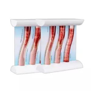 인체해부도 혈관모형 동맥 심장학 단면 경화증 교육용 모델