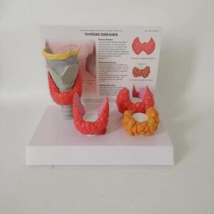의대생 인체 해부학 Thyroid 모형 병리학 소화 시스템 디스플레이 연구 교육 도구
