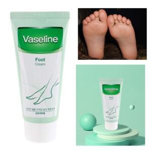 각화형 크림 발건조증 풋크림 발껍질 벗겨짐 발바닥 껍질 수포 갈라진뒤꿈치 보습