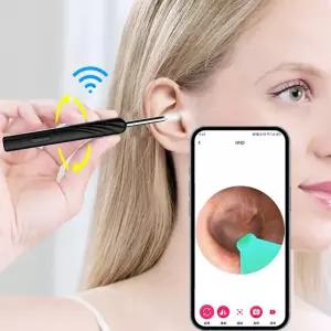 귀지 제거 귀 후비개 청소기 무선 LED 라이트 구강 검사 클리너 성인 및 어린이용 검이경 와이파이 왁스 청