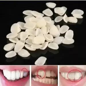 국내 미용 모형치아 키트 임시 가짜이빨 미국 판매 셀프 성형 가공 프리 사이즈 50ea