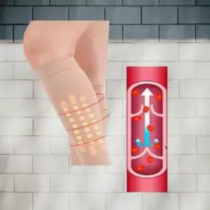 하지 정맥류 압박 스타킹 밴드 종아리 다리 관리 종아리압박밴드