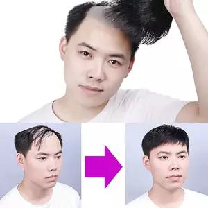 탈모가발 붙임머리 붙임머리피스 정수리 남자 머리숱 남자앞머리가발 원형