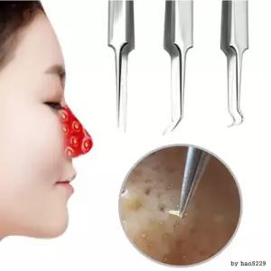 [에스에스_62]피지제거기 짜기 코 얼굴 블랙헤드 압출 바늘
