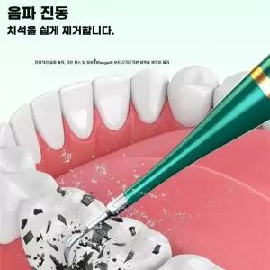 가정용 초음파 칫솔 팁 충전식 제거기 이빨 치석 구강관리 스케