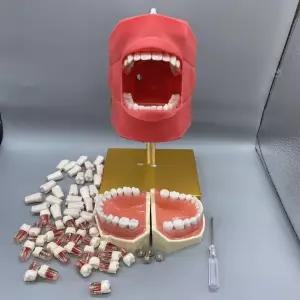잇몸 치아모델 모형 교육 구강 덴탈 치과 투명 치위생 임플란트 연습 실습용