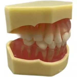 치과 치아모형 발치형 교육용 교정 덴티폼 병원 교보재 의학 학습 모델 치의학