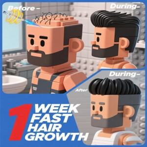 2세대 레이저. 7일 안에 대머리와 탈모에 작별을 고하세요