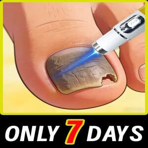 강력한 항진균 네일 트리트먼트로 깨끗하고 튼튼한 만들어보세요.