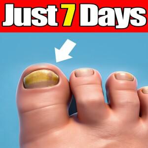 2세대, 재생기 - 곰팡이 예방 기술 조절 가능 제어 및 안전 센서