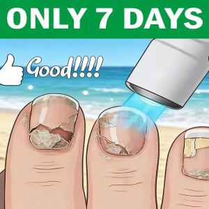 , 5세대 샴페인 색상 네일 레이저 펜, 당신의 손톱을 아름답게 만들어줄 것입니다.