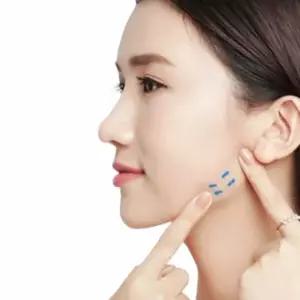 테이프 40p 리프팅밴드 페이스리프팅 주름 팔자주름패치 얼굴리프팅테이프 리프팅