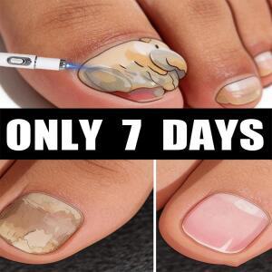 2세대 레이저 펜은 당신이 온유코미코시스에게 작별을 고 있도록 도와줍니다.