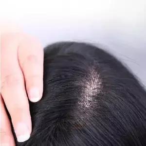 가발 정수리 대머리 헤어 나노스 남자 가르마 통기성