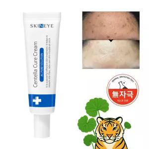 스킨아이 여드름 진정+흉터완화 AC퓨어 센텔라큐어크림 20ml