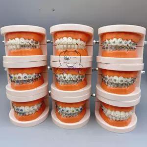 치과 치아 실습 기구 교정 치열 틀니 모형 브라켓 덴티폼 판매