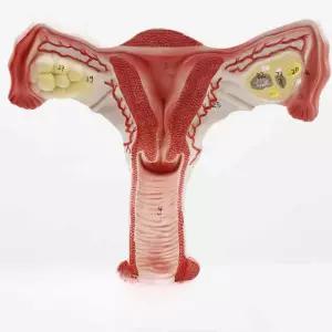 자궁 모형 해부학 여성 생식기 모델 의료 교육용 교구