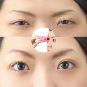 아이스트레쳐 실리콘 눈뜨는 힘 운동 눈매 눈꺼풀 짝눈 안검하수 처짐 근육 리프팅 운동