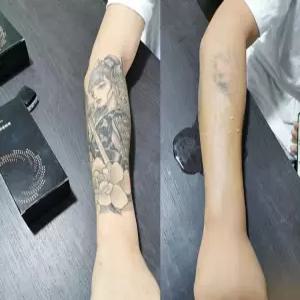 흉터 컨실러스티커 타투 가리개 문신 커버 살색 점 멍 헤나 시트