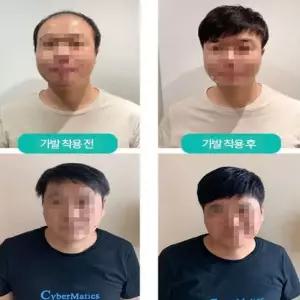 자연스러운 남성용 부족한 머리숱 부분가발 정수리부분가발