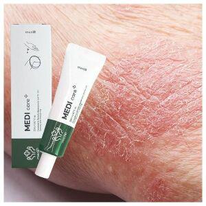 피부장벽강화 피부결개선 크림 건조 케어 수분 가려움증 보습